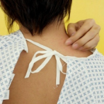 Eczema-cauze si tratament Eczema-cauze si tratament